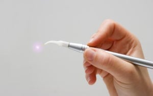Laser dentistry technology