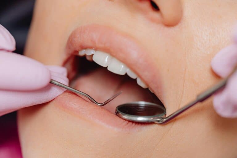 The 6-Month Rule: Why Regular Dental Checkups Matter More Than You Think